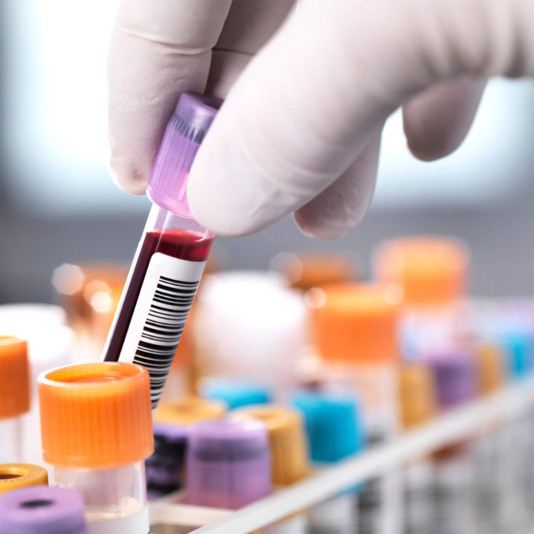 Clinical Trials
